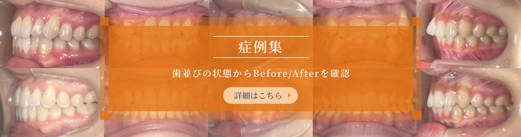 症例集 詳細はこちら